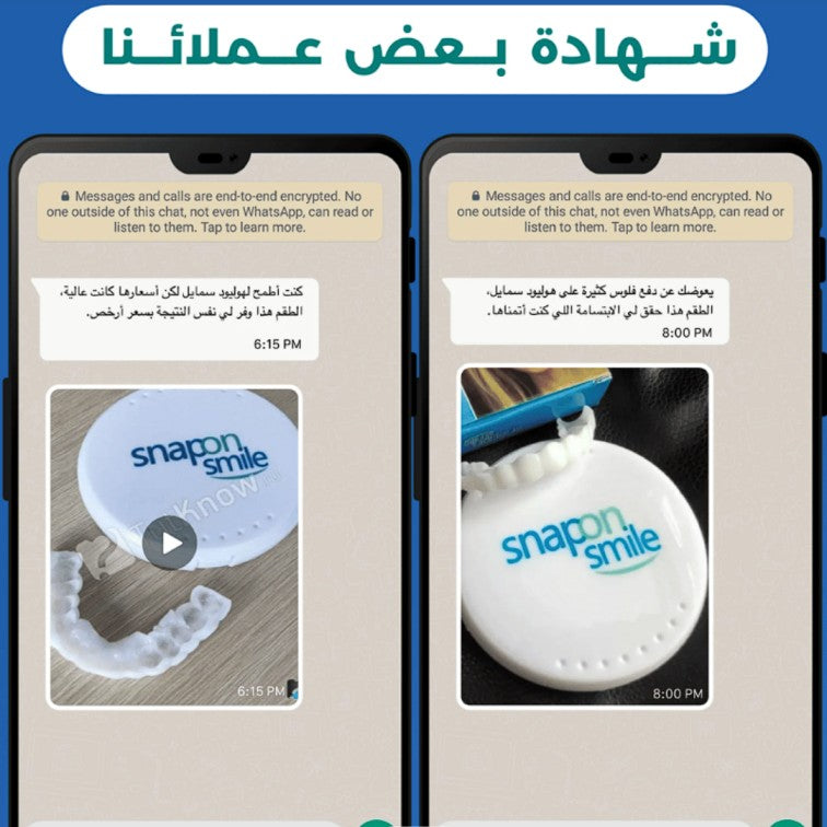 Snap-On Smile