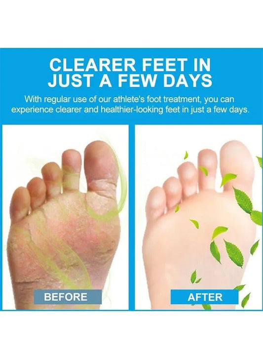 Sumifun - Foot Anti-Bacterial Cream