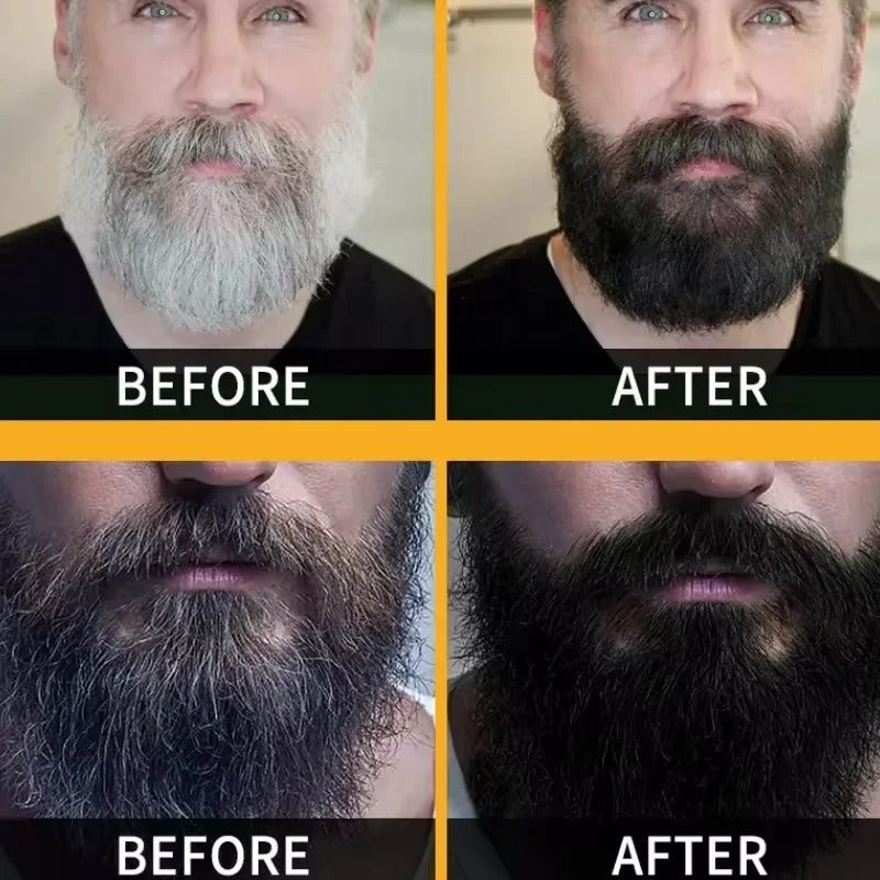 𝐏𝐨𝐥𝐲𝐠𝐨𝐧𝐮𝐦 𝐇𝐚𝐢𝐫 Darkening Soap - صابون سواد الشعر