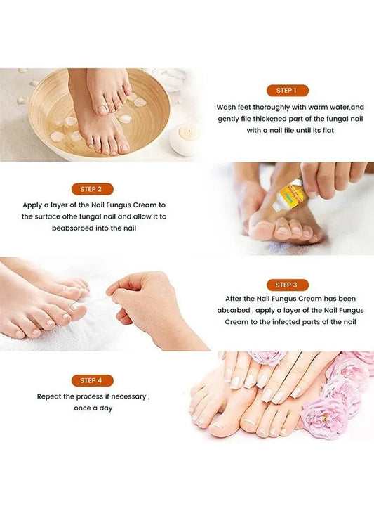 Sumifun - Bee Venom Fungal Nail Treatment Cream