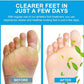 Sumifun - Foot Anti-Bacterial Cream