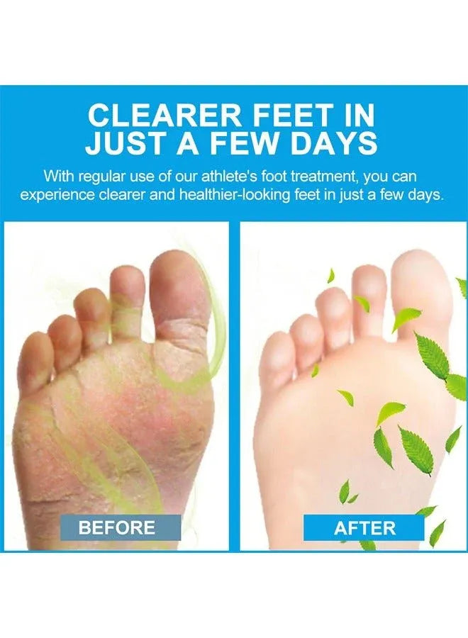 Sumifun - Foot Anti-Bacterial Cream