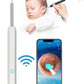 Earwax Removal Kit