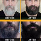 𝐏𝐨𝐥𝐲𝐠𝐨𝐧𝐮𝐦 𝐇𝐚𝐢𝐫 Darkening Soap - صابون سواد الشعر